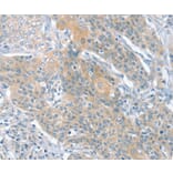 Immunohistochemistry - SLIT2 Antibody from Signalway Antibody (37951) - Antibodies.com