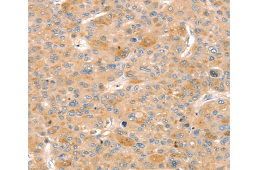 Immunohistochemistry - SLIT3 Antibody from Signalway Antibody (37952) - Antibodies.com