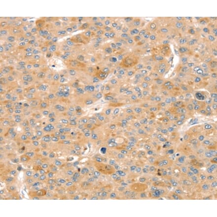 Immunohistochemistry - SLIT3 Antibody from Signalway Antibody (37952) - Antibodies.com