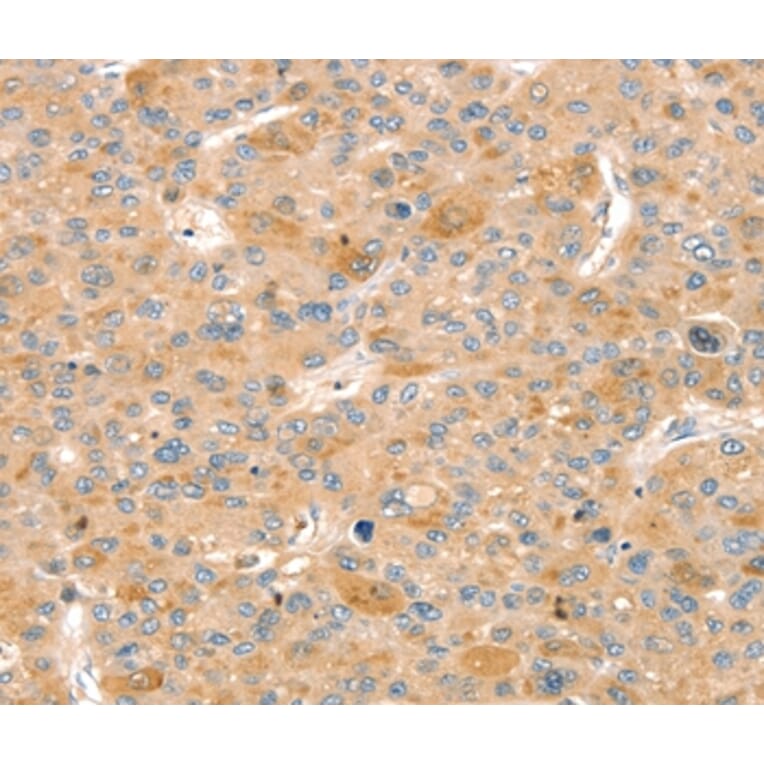 Immunohistochemistry - SLIT3 Antibody from Signalway Antibody (37952) - Antibodies.com