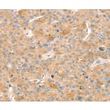 Immunohistochemistry - SLIT3 Antibody from Signalway Antibody (37952) - Antibodies.com