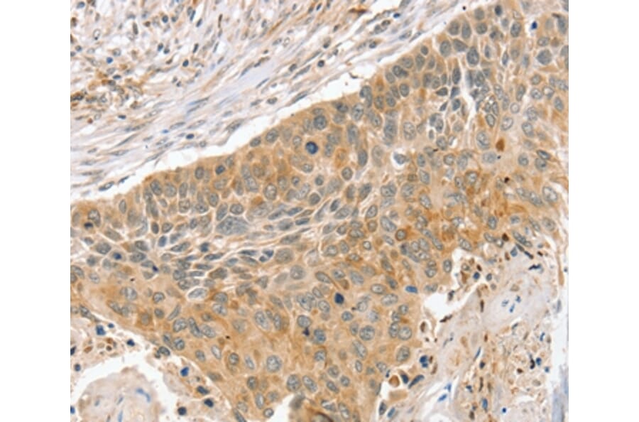 Immunohistochemistry - SLIT3 Antibody from Signalway Antibody (37952) - Antibodies.com