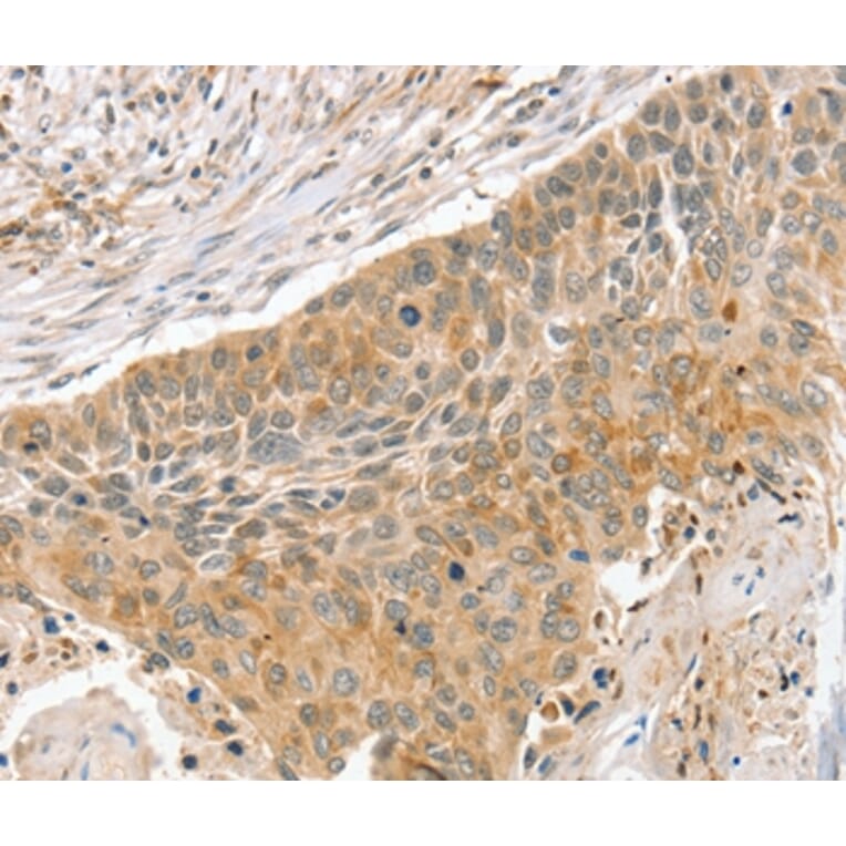 Immunohistochemistry - SLIT3 Antibody from Signalway Antibody (37952) - Antibodies.com