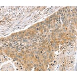 Immunohistochemistry - SLIT3 Antibody from Signalway Antibody (37952) - Antibodies.com