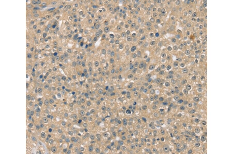 Immunohistochemistry - SMAGP Antibody from Signalway Antibody (37954) - Antibodies.com