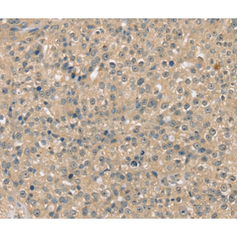 Immunohistochemistry - SMAGP Antibody from Signalway Antibody (37954) - Antibodies.com