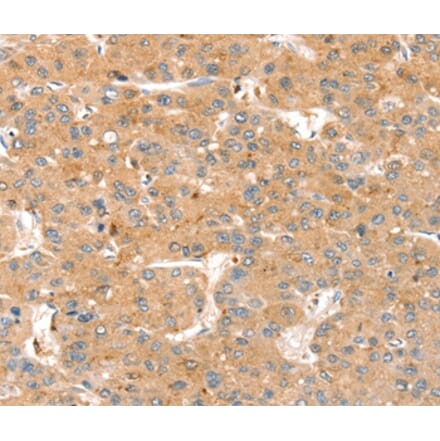 Immunohistochemistry - SMOC2 Antibody from Signalway Antibody (37960) - Antibodies.com