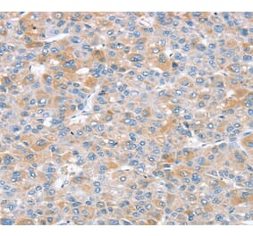 Immunohistochemistry - SNX25 Antibody from Signalway Antibody (37965) - Antibodies.com