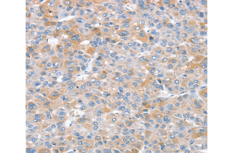Immunohistochemistry - SNX25 Antibody from Signalway Antibody (37965) - Antibodies.com