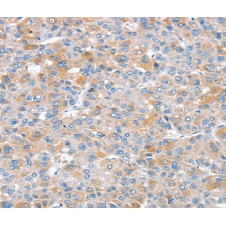 Immunohistochemistry - SNX25 Antibody from Signalway Antibody (37965) - Antibodies.com