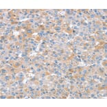 Immunohistochemistry - SNX25 Antibody from Signalway Antibody (37965) - Antibodies.com