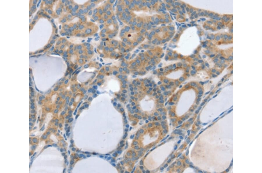 Immunohistochemistry - SNX29 Antibody from Signalway Antibody (37966) - Antibodies.com
