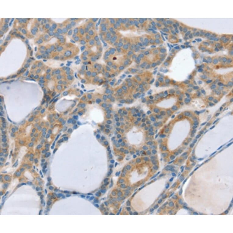 Immunohistochemistry - SNX29 Antibody from Signalway Antibody (37966) - Antibodies.com