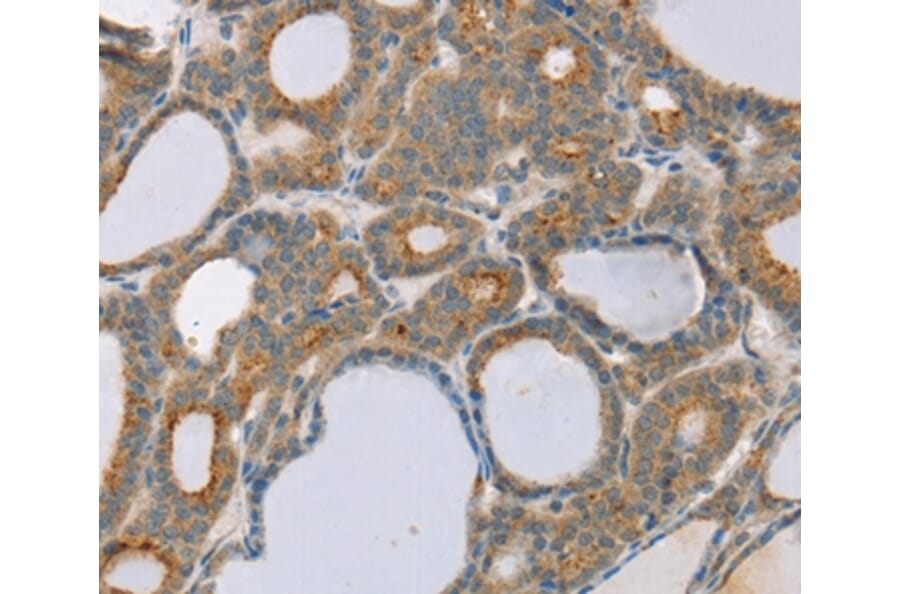 Immunohistochemistry - SNX30 Antibody from Signalway Antibody (37967) - Antibodies.com