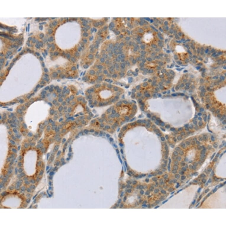 Immunohistochemistry - SNX30 Antibody from Signalway Antibody (37967) - Antibodies.com