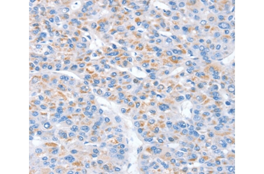 Immunohistochemistry - SNX33 Antibody from Signalway Antibody (37968) - Antibodies.com
