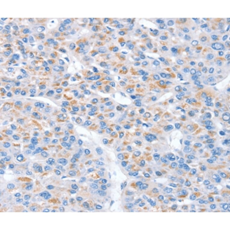 Immunohistochemistry - SNX33 Antibody from Signalway Antibody (37968) - Antibodies.com