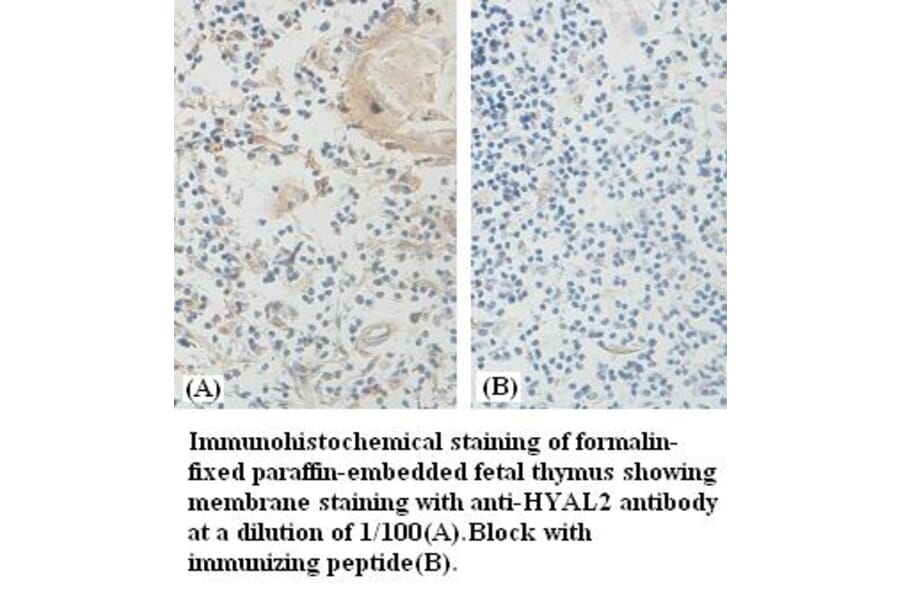 HYAL2 Antibody from Signalway Antibody (39385) - Antibodies.com