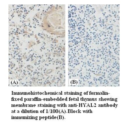 HYAL2 Antibody from Signalway Antibody (39385) - Antibodies.com