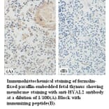 HYAL2 Antibody from Signalway Antibody (39385) - Antibodies.com