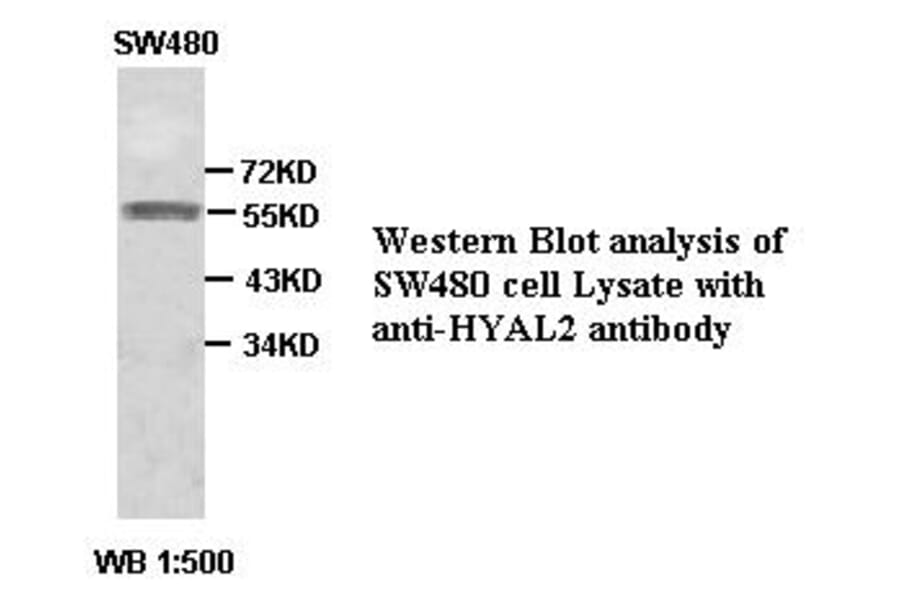 HYAL2 Antibody from Signalway Antibody (39385) - Antibodies.com