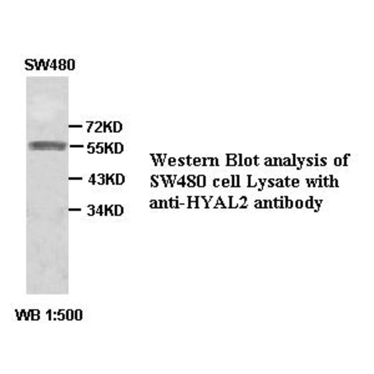 HYAL2 Antibody from Signalway Antibody (39385) - Antibodies.com