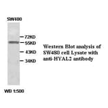 HYAL2 Antibody from Signalway Antibody (39385) - Antibodies.com