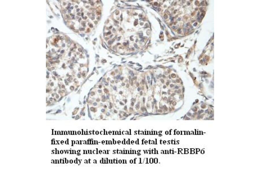 RBBP6 Antibody from Signalway Antibody (39408) - Antibodies.com