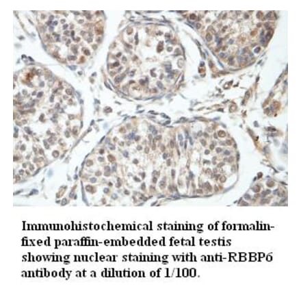 RBBP6 Antibody from Signalway Antibody (39408) - Antibodies.com
