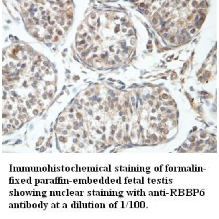 RBBP6 Antibody from Signalway Antibody (39408) - Antibodies.com
