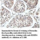 RBBP6 Antibody from Signalway Antibody (39408) - Antibodies.com