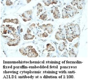 A2LD1 Antibody from Signalway Antibody (39425) - Antibodies.com