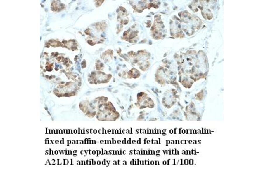 A2LD1 Antibody from Signalway Antibody (39425) - Antibodies.com