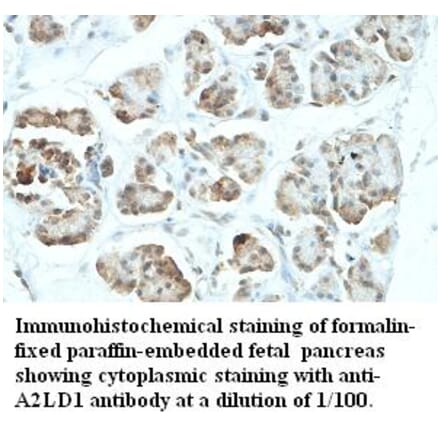 A2LD1 Antibody from Signalway Antibody (39425) - Antibodies.com