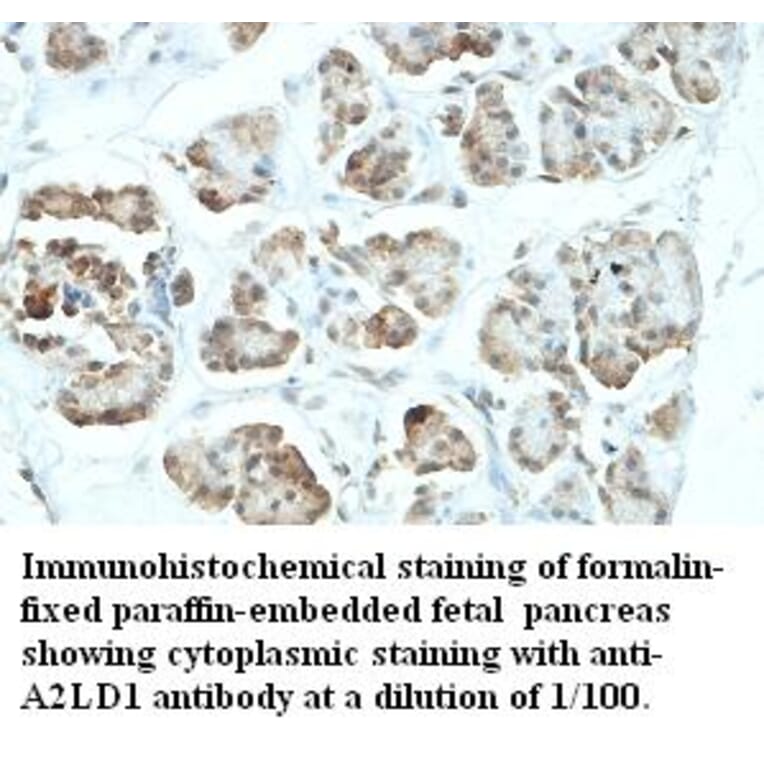 A2LD1 Antibody from Signalway Antibody (39425) - Antibodies.com