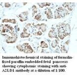 A2LD1 Antibody from Signalway Antibody (39425) - Antibodies.com