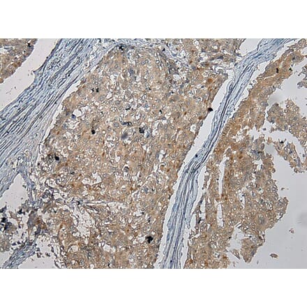 Immunohistochemistry - CENPM Antibody from Signalway Antibody (40060) - Antibodies.com
