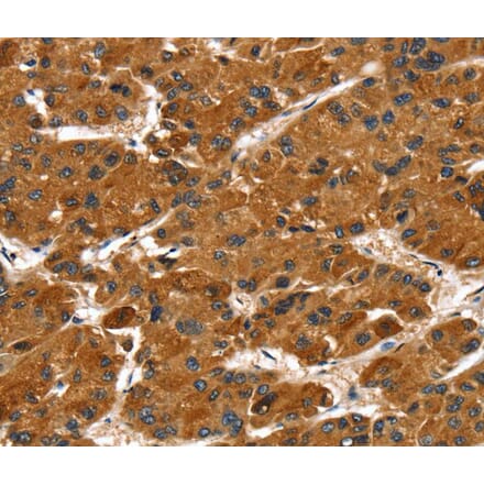 Immunohistochemistry - PTPN5 Antibody from Signalway Antibody (40066) - Antibodies.com