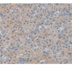 Immunohistochemistry - RASA4 Antibody from Signalway Antibody (40069) - Antibodies.com