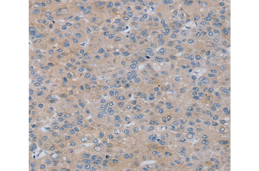 Immunohistochemistry - RASA4 Antibody from Signalway Antibody (40069) - Antibodies.com