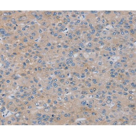 Immunohistochemistry - RASA4 Antibody from Signalway Antibody (40069) - Antibodies.com