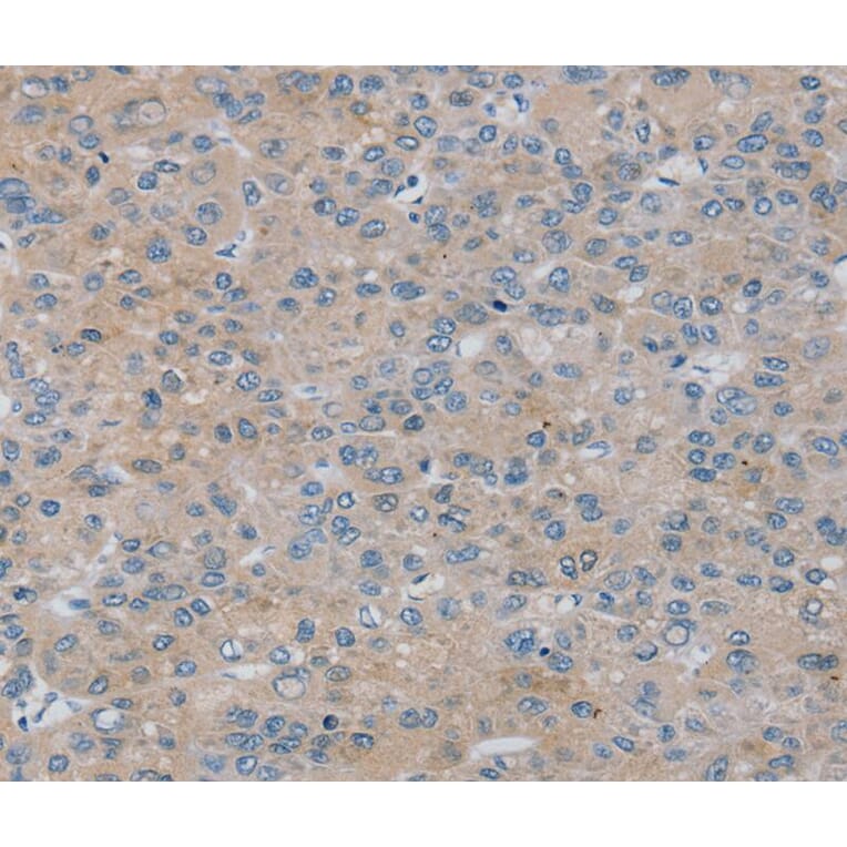 Immunohistochemistry - RASA4 Antibody from Signalway Antibody (40069) - Antibodies.com