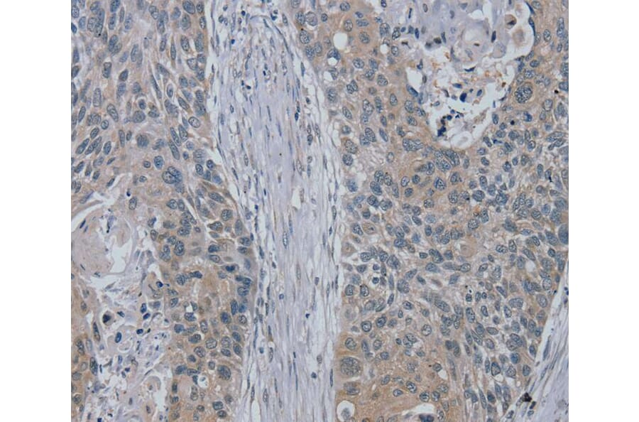 Immunohistochemistry - RASA4 Antibody from Signalway Antibody (40069) - Antibodies.com