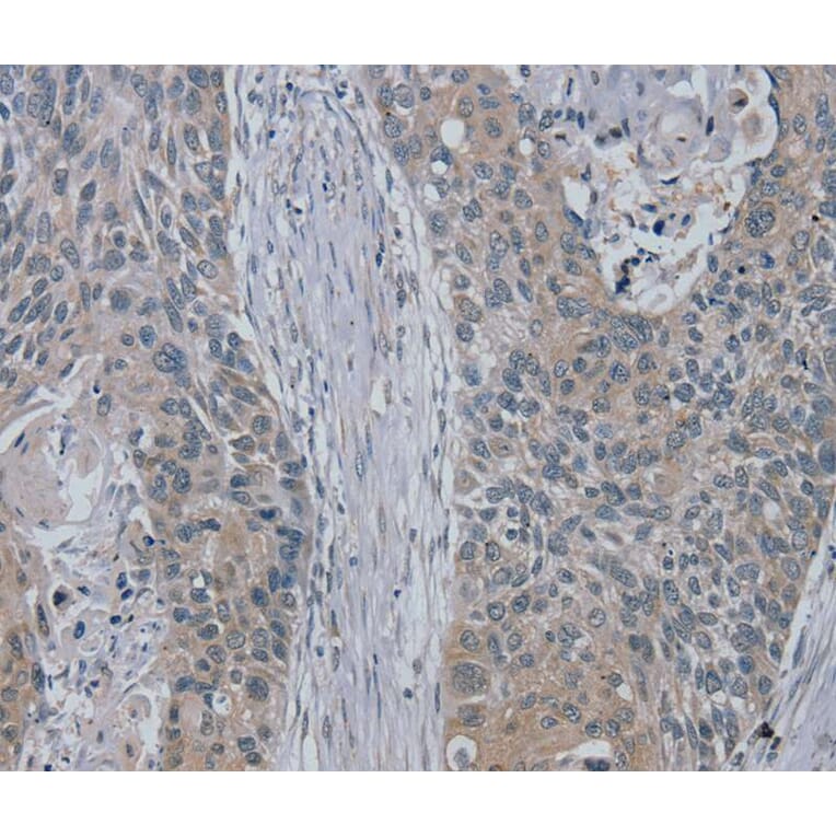 Immunohistochemistry - RASA4 Antibody from Signalway Antibody (40069) - Antibodies.com