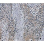 Immunohistochemistry - RASA4 Antibody from Signalway Antibody (40069) - Antibodies.com