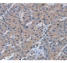 Immunohistochemistry - RGS11 Antibody from Signalway Antibody (40074) - Antibodies.com