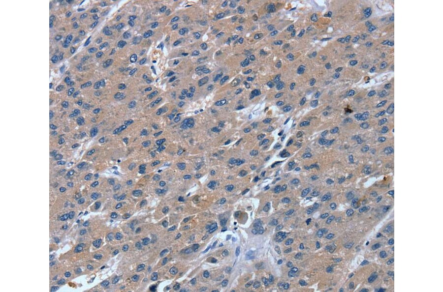 Immunohistochemistry - RGS11 Antibody from Signalway Antibody (40074) - Antibodies.com