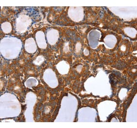 Immunohistochemistry - RNF11 Antibody from Signalway Antibody (40081) - Antibodies.com