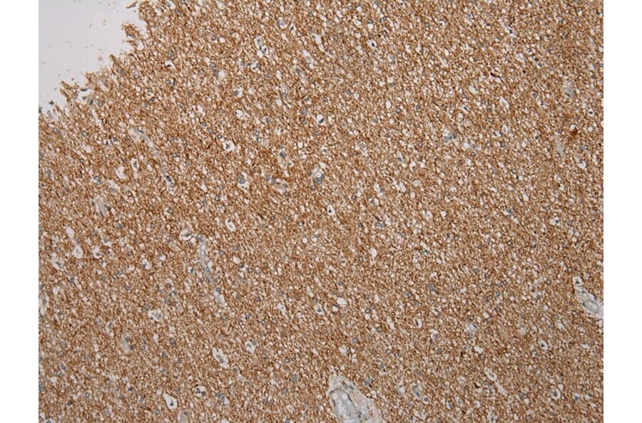 Immunohistochemistry - ROBO3 Antibody from Signalway Antibody (40083) - Antibodies.com