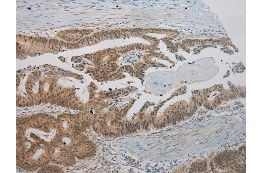 Immunohistochemistry - ROBO3 Antibody from Signalway Antibody (40083) - Antibodies.com